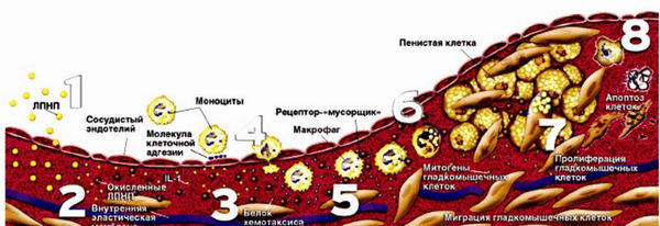 Липопротеины крови и атеросклероз thumbnail